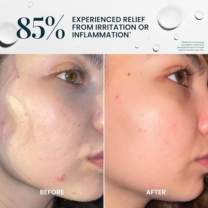 FlutterHabit Hypochlorous Acid Spray, Face Mist for Acne Prone Skin, HOCl Formula to Soothe Irritation, Refresh Complexion, Repair Damage, Balance Oil, Calm Redness, Restore Clarity (125mL)-FemmiqueWomen