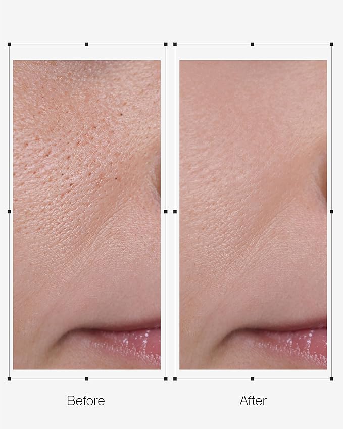 Oganacell DERX Cleanser - Walnut Cleanser for Clogged Pores, Gentle Daily Exfoliant for Smooth Skin, Korean Skin Care Face Wash, 4.05 fl oz