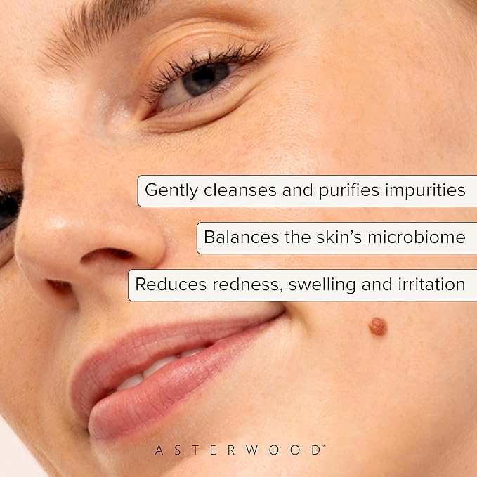 Asterwood Hypochlorous Acid Spray for Face - Targets Acne, Redness, Irritation - Multi-Purpose Skin Repair - Antibacterial, Antimicrobial - After Gym/Post-Workout Facial Mist - 4 Fl Oz-FemmiqueWomen