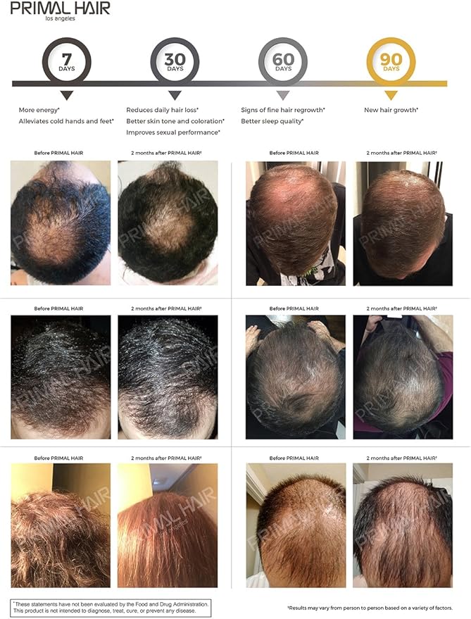 100% Natural Growth Treatment, Reduces Hair Loss, US Patented Formula Proven Effective for Men & Women, 100% Vegan Ingredients, Non-GMO, 30-Day Supply-FemmiqueWomen