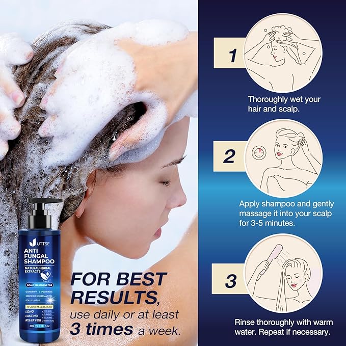 Anti-Fungal Shampoo for Scalp Psoriasis: Dandruff Shampoo for Folliculitis and Seborrheic Dermatitis - Relieves Itchy & Dry Scalp - 300 mL / 10.1 fl.oz-FemmiqueWomen