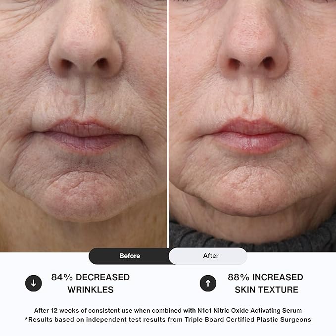 Moisturizer Face Cream - Day & Night Face Moisturizer with Nitric Oxide, Peptide Complex, Epidermal Growth Factor - Tightening & Firming Skin Care Products for Wrinkles, Dark Spots - 1.75 oz.-FemmiqueWomen