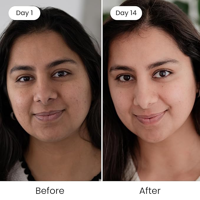 Shankara Kumkumadi Oil with Pure Saffron and Ayurvedic Herbs (Original Aroma 18ml)-FemmiqueWomen