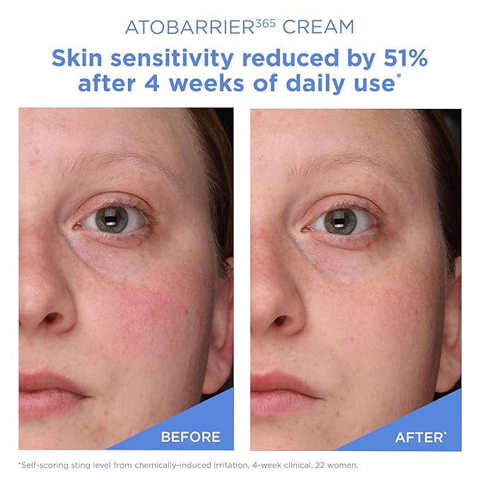 AESTURA ATOBARRIER365 Cream with Ceramides, Korean Face Moisturizer for Barrier Repair | 120H lasting Hydration, Ceramide Capsules, Dry & Sensitive Skin, Non-comedogenic, 80 mL / 2.70 fl.oz.-FemmiqueWomen