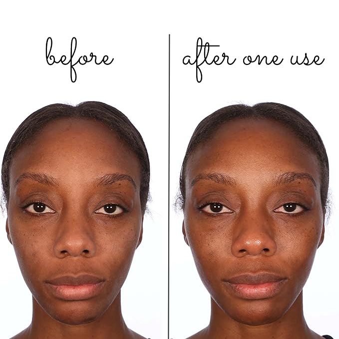 Consult Beaute Volumagen Miracle Plumping Barrier Balm - Facial Moisture Slugging - Overnight Deep Skin Hydration - Dry Skin - Hyaluronic Acid - Petrolatum Free - Lanolin Free - Mineral Oil Free 1 oz-FemmiqueWomen