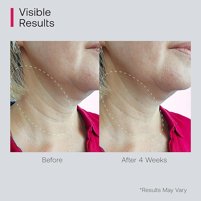 Retinol Neck Firming Cream with Cooling & Massaging Roller Applicator - Hydrates, Lifts, Smoothes Wrinkles, Fine Lines & Tightens Sagging Skin with Niacinamide & Hyaluronic Acid, 1.7oz/50g-FemmiqueWomen