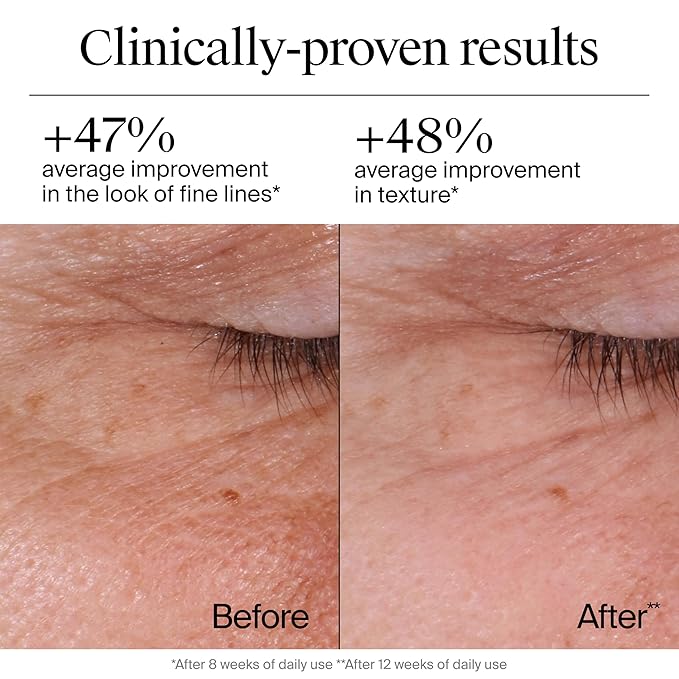 Neutrogena Rapid Wrinkle Repair Retinol Face Moisturizer, Daily Anti-Aging Face Cream with Retinol & Hyaluronic Acid to Fight Fine Lines, Wrinkles, & Dark Spots, 1.7 oz-FemmiqueWomen