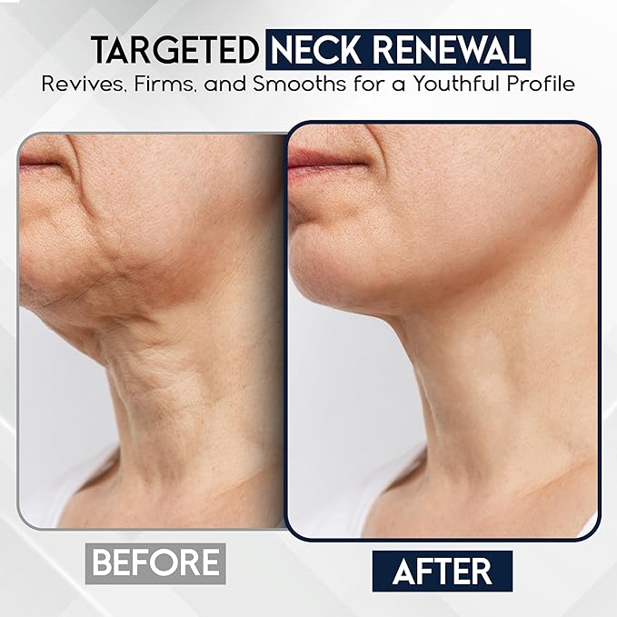 Neck Creams for Tightening and Firming Sagging Skin - Skin Tightening Cream for Face - Decollete & Chest, Under Chin Firming for Older Women - Neck Wrinkles Treatment with Collagen & Hyaluronic Acid-FemmiqueWomen