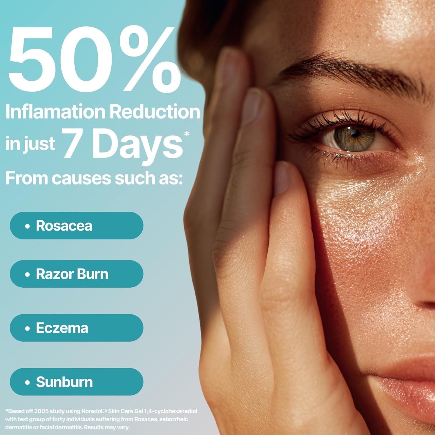 Skin Care Gel - Redness Relief Moisturizer for Dry Skin - Rosacea Treatment for Face - Soothes Prone Skin and Irritation - Fragrance Free 1 oz-FemmiqueWomen