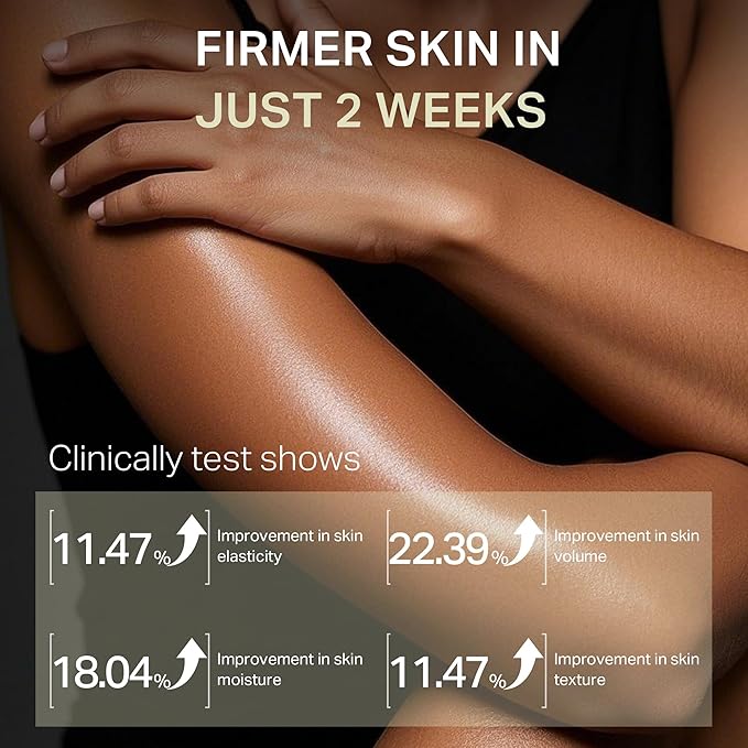 Ultra-Size Firming Retinol Body Lotion for Crepey Skin & Keratosis Pilaris with 0.05% Retinol, AHA, Collagen, Body Cream, Anti Aging Moisturizer 10.14 fl oz-FemmiqueWomen