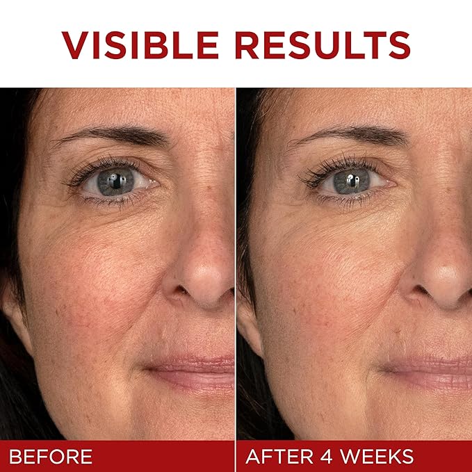 L'Oreal Paris Revitalift Triple Power Anti-Aging Face Moisturizer, Pro Retinol, Hyaluronic Acid & Vitamin C, Reduce Wrinkles 2.55 Oz-FemmiqueWomen