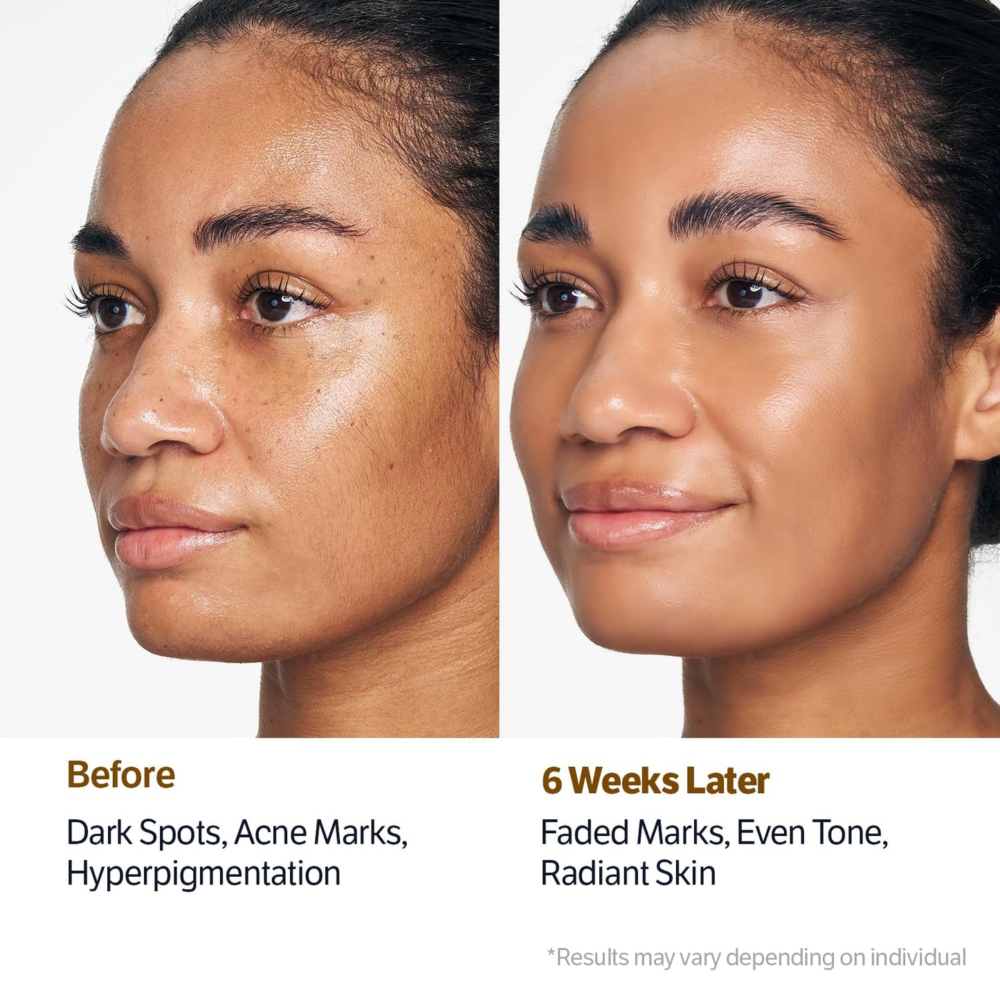 SUNGBOON EDITOR Kojic Acid Niacinamide Face Wash | Turmeric Cleanser for Dark Spots & Radiance | Korean Skin Care with Hyaluronic Acid | Gentle Makeup Remover & Blackhead Cleanser-FemmiqueWomen