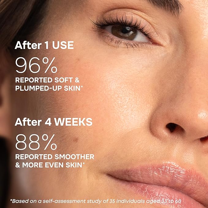 SimplyVital Moisturizer for Neck & Décolleté – With Collagen, Retinol, Peptides & Hyaluronic Acid – Anti-Aging Hydration – Made in USA – 1 fl.oz-FemmiqueWomen