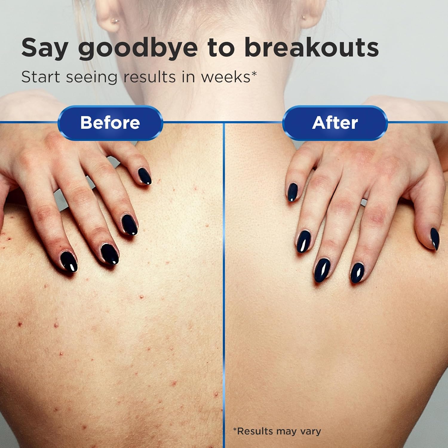 Non-Comedogenic Clear 2 Perfection Shampoo - Sulfate & Paraben-Free for Clear, Healthy Skin & Hair - Esthetician Formulated-FemmiqueWomen