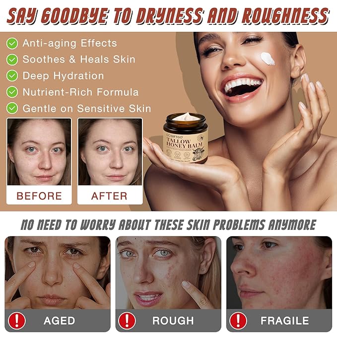 Beef Tallow for Skin,Tallow and Honey Balm,Beef Tallow for Face,Tallow Face Moisturizer,Natural Moisturizer Hydrates,Deeply Nourishes the Skin, Enhances Natural Radiance (1pcs)-FemmiqueWomen