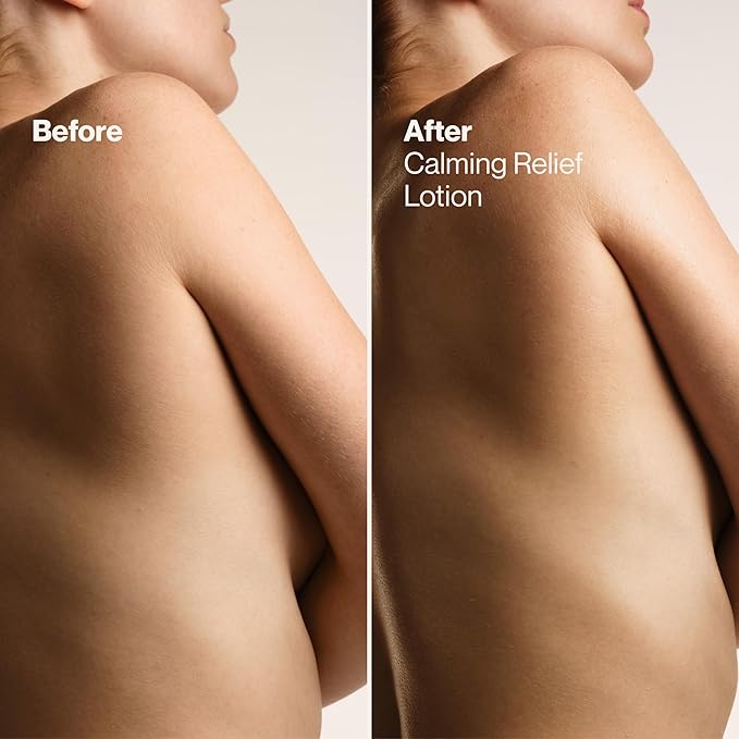 Suave Calming Relief Hand & Body Lotion for Women With Prebiotics For Sensitive Skin, Fragrance & Allergen Free, Helps Restore Skin's Moisture Barrier, 18 FL OZ, 6 Pack-FemmiqueWomen