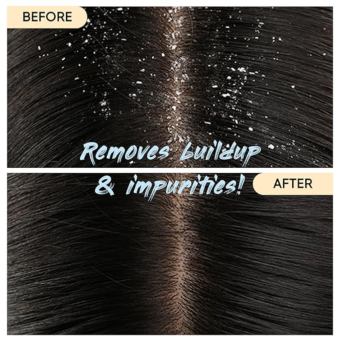 Charcoal Shampoo Bar 2.0 - Hydrating & Moisturizing Natural Hair Soap Bar Shampoo for Excess Oil Build-Up & Scalp Nourishment - Bathing Soap Solid Shampoo for All Hair Types (120g, 4.23oz)-FemmiqueWomen