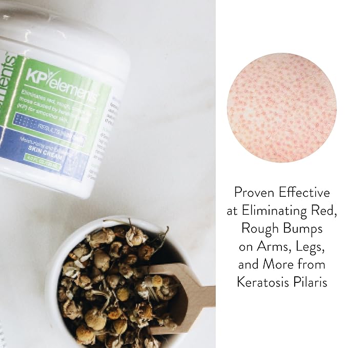 KP Elements Keratosis Pilaris Lotion (4 fl oz) - Natural Keratosis Pilaris Treatment, Moisturizing & Exfoliating AHA Lotion for KP, Vegan, Made in USA-FemmiqueWomen