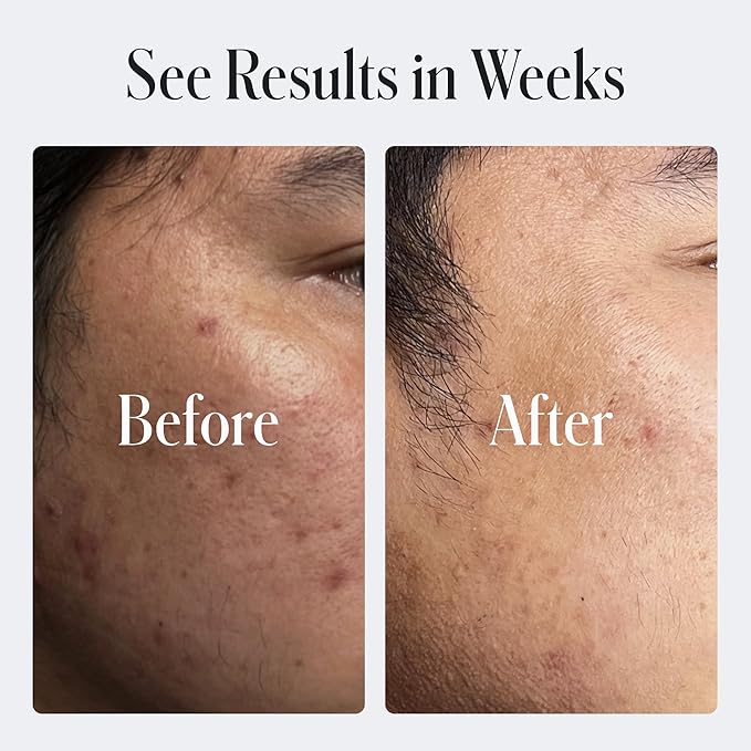 Geologie Skin Repair Moisturizer Face Cream | Clear System Retinol Resurfacing Formula | For Blemish Prone Skin with Niacinamide & Hyaluronic Acid | 60 ML-FemmiqueWomen