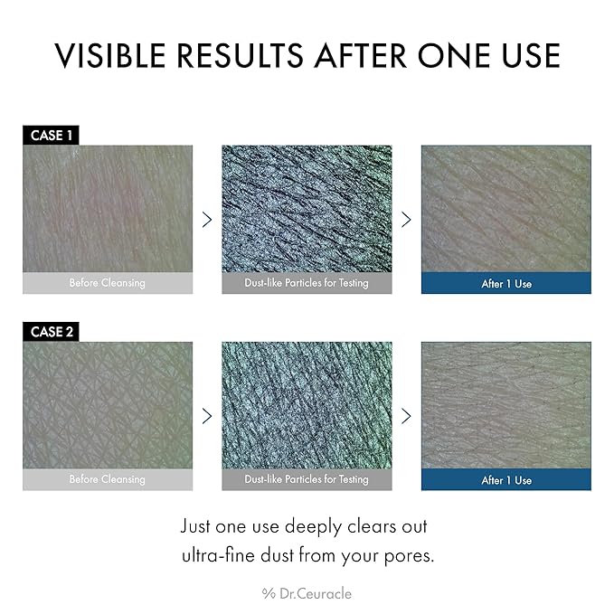 Dr.Ceuracle Pro Balance Enzyme Powder Face Wash - Korean Day and Night Natural Enzyme Powder Face Wash for Deep Pore Cleansing, Sebum Removing, pH Skin Balancing Care (Night Wash)-FemmiqueWomen