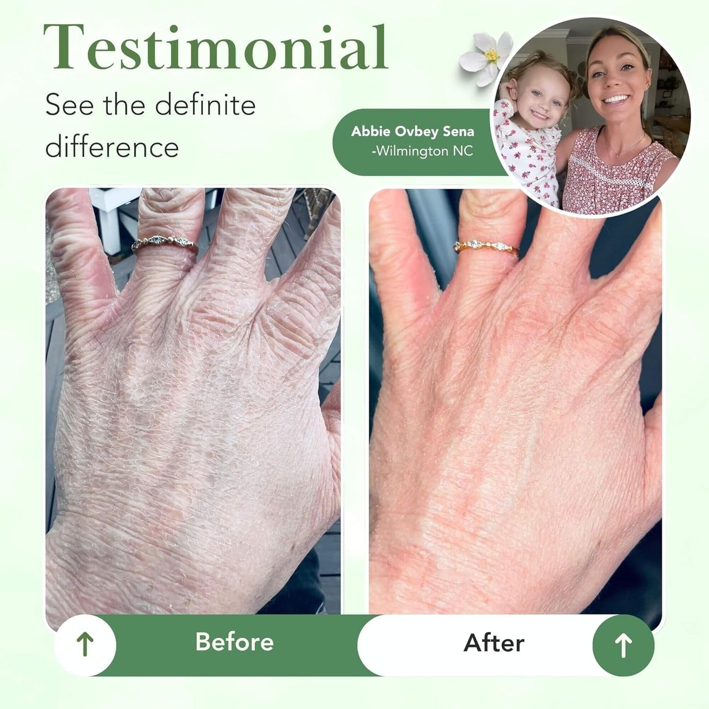 Theraplex Skin Barrier Balm- Barrier Repair Moisturizer Cream Body Balm Dry, Sensitive Skin - No Parabens or Preservatives, Noncomedogenic and Hypoallergenic - Dermatologist Recommended - 6 Oz-FemmiqueWomen