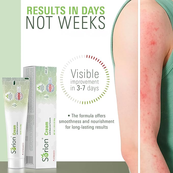 Sorion Cream - Herbal Moisturizer for Dry, Itchy, Flaky Skin with Coconut Oil, Neem, Turmeric and Pala Indigo Plant Skincare-FemmiqueWomen