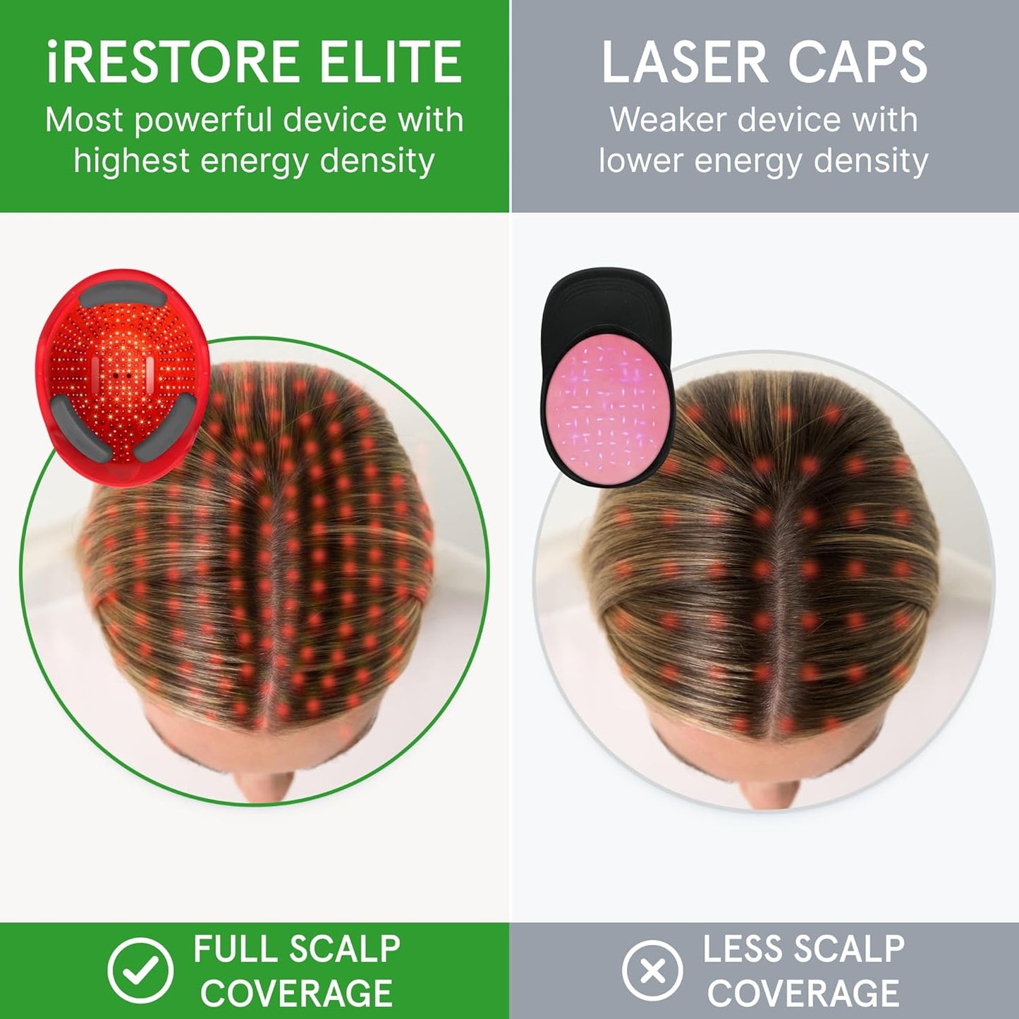 iRestore Elite + Rechargeable Battery Pack - Laser Red Light Therapy for Hair Growth - FDA Cleared Hair Loss, Hair Thinning Treatment for Men & Women - Hair Regrowth Laser Cap - 500 Lasers & LEDs-FemmiqueWomen