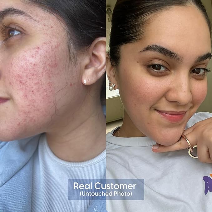 Strive Hydrating Men's Face Wash - Deep Cleans Pores, Exfoliates & Brightens - Refreshing Aloe Vera, Hyaluronic Acid & Niacinamide - Fragrance Free Men's Skincare - 200ml-FemmiqueWomen