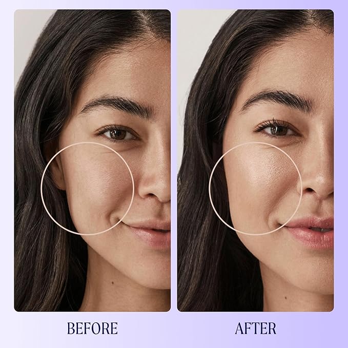 Kinship Zinc Oxide Mineral Sunscreen for Face Self Reflect SPF 32 | Vegan, Reef Safe, Non Toxic Eczema Sunscreen for Sensitive Skin | Sunblock Face Moisturizer with SPF (1.75 oz)-FemmiqueWomen