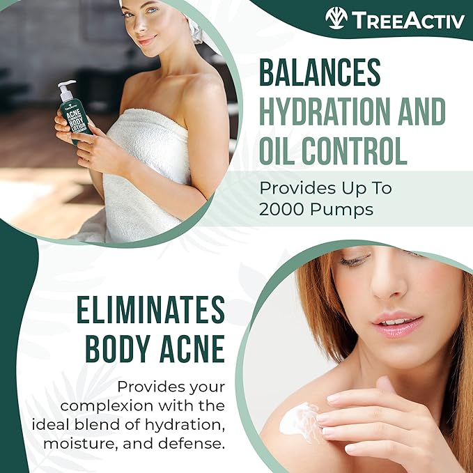 TreeActiv Acne Eliminating Body Lotion 8 fl oz | Clears Body, Back, Butt and Shoulder Acne | Anti-Acne Moisturizer | Prevents Future Breakouts | Cucumber Mint Scent-FemmiqueWomen