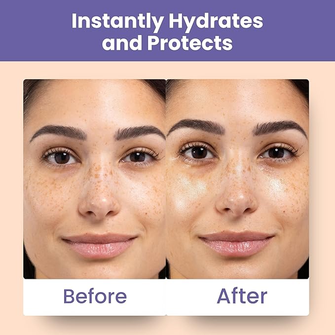 Patchology Skin Remedy Calm & Protect Micro Mist – Hydrating Facial Spray with Ectoin, Probiotics & Botanical Blend - Fragrance Free - Refines Pores & Leaves a Fresh Glow - 80 mL-FemmiqueWomen