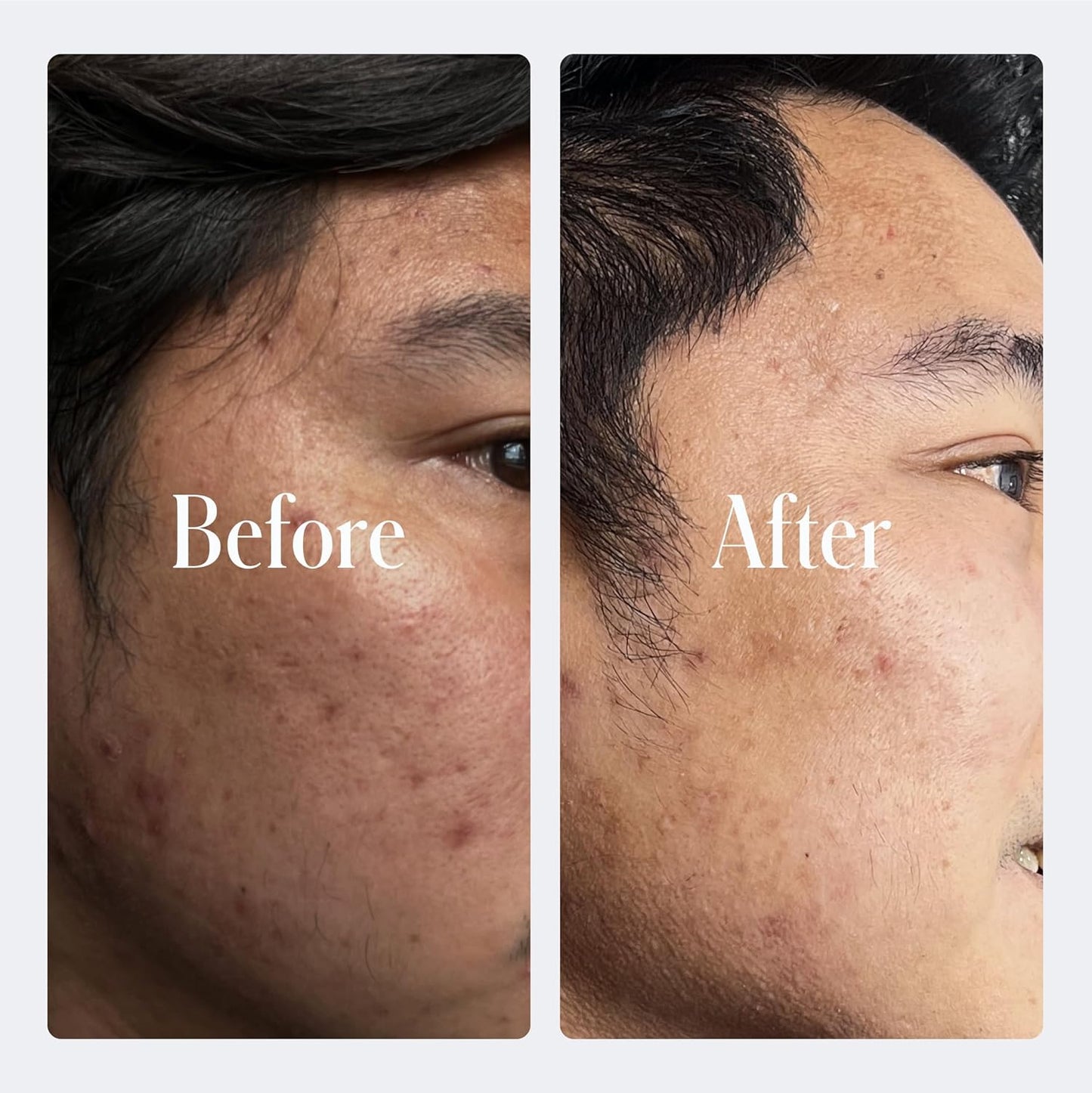 Geologie Retinol Anti-Aging Face Cream | Advanced .3% Retinol Formula for Effective Results | Reduce Fine Lines & Wrinkles | Protect & Repair Skin With Hyaluronic Acid & Niacinamide | For Men & Women-FemmiqueWomen