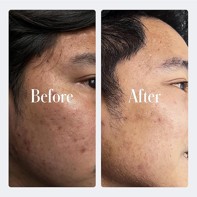 Geologie Retinol Anti-Aging Face Cream | Enhanced .2% Retinol Formula for Effective Results | Reduce Fine Lines & Wrinkles | Protect & Repair Skin With Hyaluronic Acid & Niacinamide | For Men & Women-FemmiqueWomen