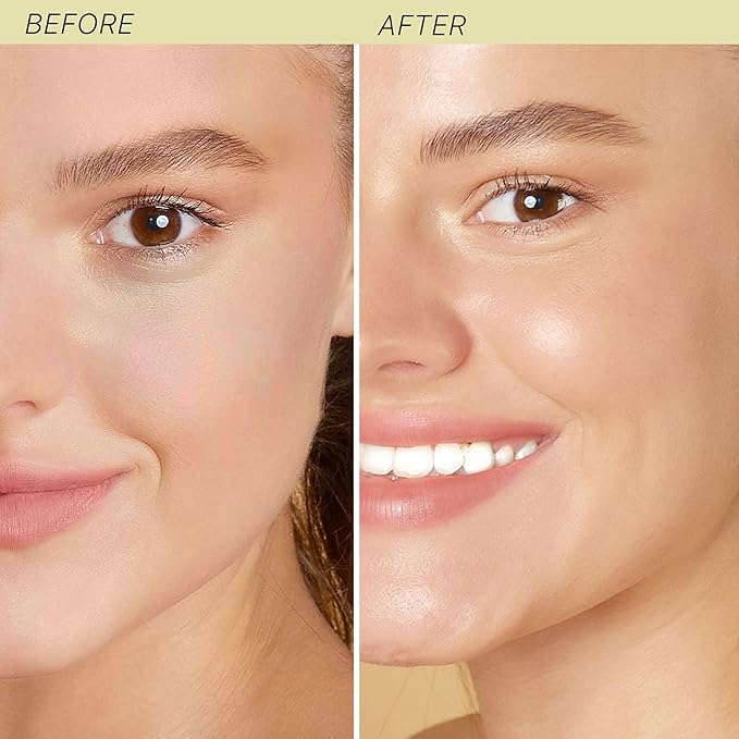 Hyaluronic Acid Moisturizer for Face - USA Made with Organic & Natural Ingredients, Hydrating Anti Aging Face Moisturizer for Dry Skin with Glycerin & Vitamin E, Unscented Anti Wrinkle Cream-FemmiqueWomen