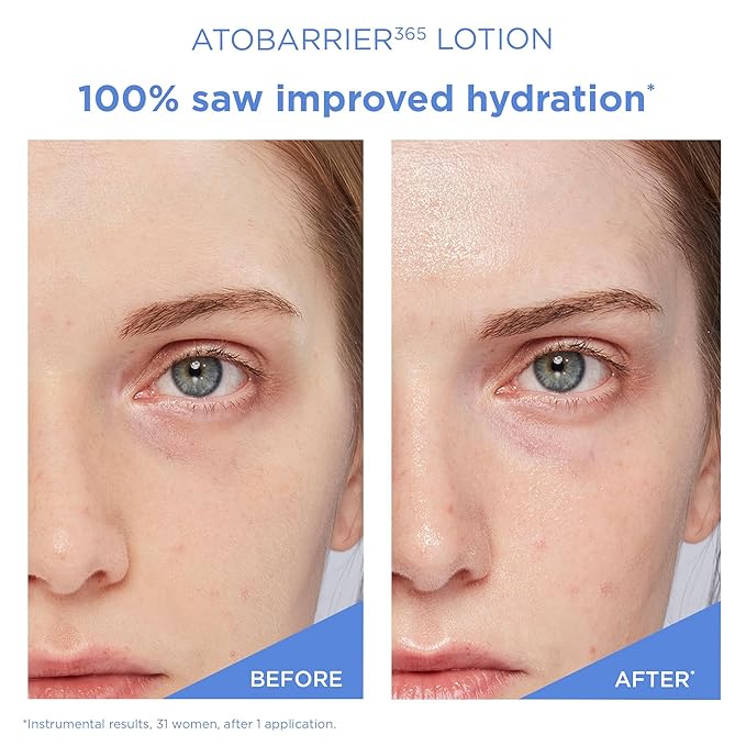 AESTURA ATOBARRIER365 Lightweight Cream + Facial Mist-FemmiqueWomen