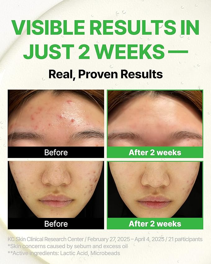 Trouble Control Pad | Korean Toner for Oily, Sensitive & Acne-Prone Skin – Exfoliating Facial Pads with Dual Cotton Rounds & Calming Botanicals (70 Pads)-FemmiqueWomen