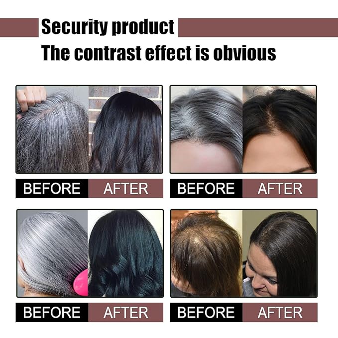 3PCS Hira Darkening Polygonum Shampoo Bar for Gray, Thinning Hair and Hair Growth (he shouwu) - Soap Bar-FemmiqueWomen