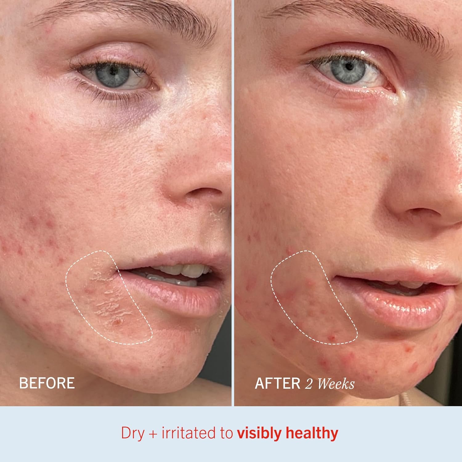 First Aid Beauty - Ultra Repair Cream, Intense Hydration Whipped Colloidal Oatmeal, Strengthens Skin Barrier in 7 Days & Helps Relieve Eczema, Luxury Face & Body Moisturizer, Grapefruit Scent, 12 oz-FemmiqueWomen