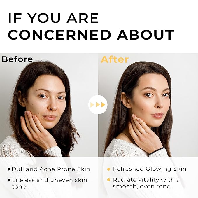 Italian White Truffle Spray Serum - Vegan Skin Care - Face Mist Hydrating Spray with Avocado & White Truffles - Face Serum for Radiant Skin - 3.38 Fl Oz-FemmiqueWomen