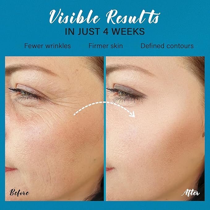 Tighten and Lift Neck Cream: Instant Face Lift Cream - 6-in-1 Anti-Aging Face Moisturizer for Anti-Wrinkle, Firm - Collagen, Retinol, Peptides & Hyaluronic Acid Neck Firming Cream for Skin Care-FemmiqueWomen