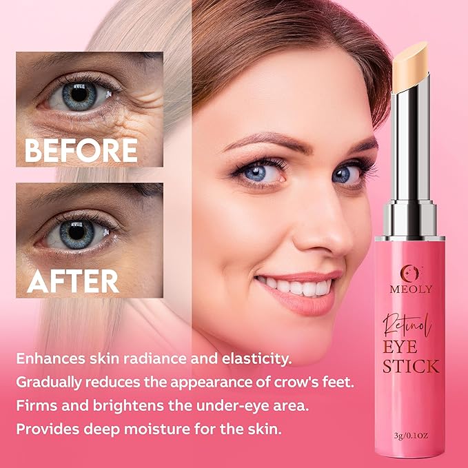 Instant Eye Bag Remover, Retinol Eye Cream for Dark Circles, Under Eye Brightener Stick, Under Eye Cream Anti Aging, Eye Cream for Wrinkles, Brightening Eye Cream for Puffiness and Bags-FemmiqueWomen