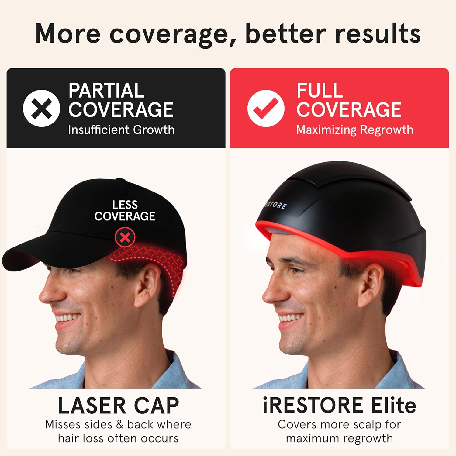 iRestore Elite - Laser Red Light Therapy for Hair Growth System - FDA Cleared Hair Loss, Hair Thinning & Alopecia Treatment for Men & Women - Laser Cap for Hair Regrowth Stimulates Denser Fuller Hair-FemmiqueWomen