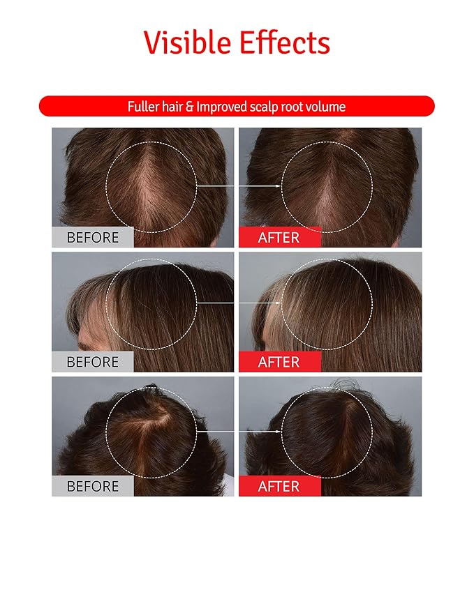 Scalp+ Shampoo for DHT Blocker, Hair Loss Relief - Moisture Anti-Aging Thickening Volumizing Fortifying & Repairing Hair Strength Fuller Hair with Vitamin C, Peptides, Biotin, 10.14 fl.oz.-FemmiqueWomen