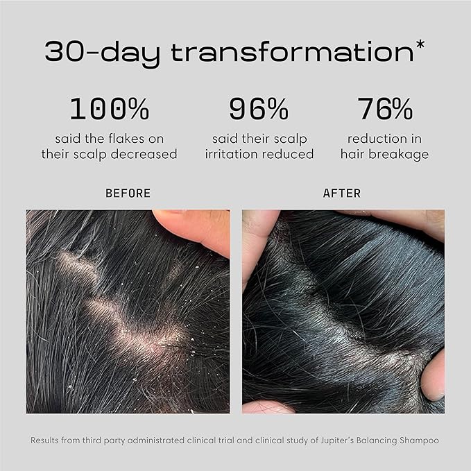 Jupiter, Physician-Formulated Anti-Dandruff Shampoo & Conditioner, for Flaky, Itchy, Oily, Dry Scalp, Vegan, Sulfate-Free, Color-Safe, & Paraben-Free, Dry Scalp Shampoo and Conditioner for Women & Men-FemmiqueWomen