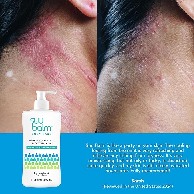 Fast Itching Relief Cream, Anti Itch Lotion for Sensitive Skin, Eczema, Psoriasis & Extreme, Very Severe & Dry Skin, Derm Formula, Menthol & Ceramides, 11.83 fl oz-FemmiqueWomen