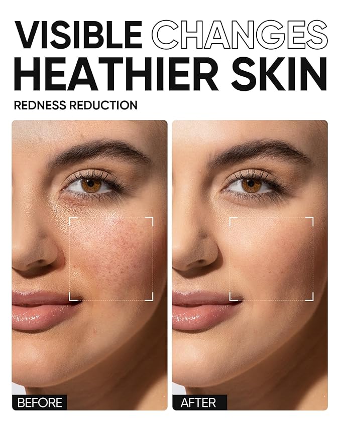 5X Ceramides Moisture Barrier Cream, Hydrating Skin Barrier Repair Face Moisturizer for All Skin Types with Hyaluronic Acid & Centella, Daily Moisturizer, Non-Comedogenic-FemmiqueWomen