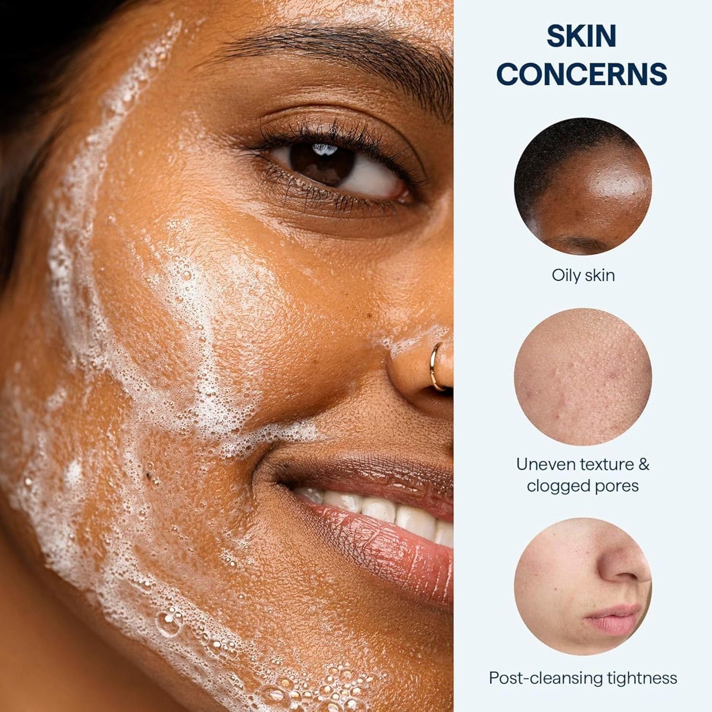 Remedy for Lightweight Cleansing - Gel to Foam Cleanser for Normal to Oily Skin - 0.5% Salicylic Acid, Ceramides, Glycerin, Green Tea - By Dermatologist Dr. Shah, 5 fl. Oz-FemmiqueWomen