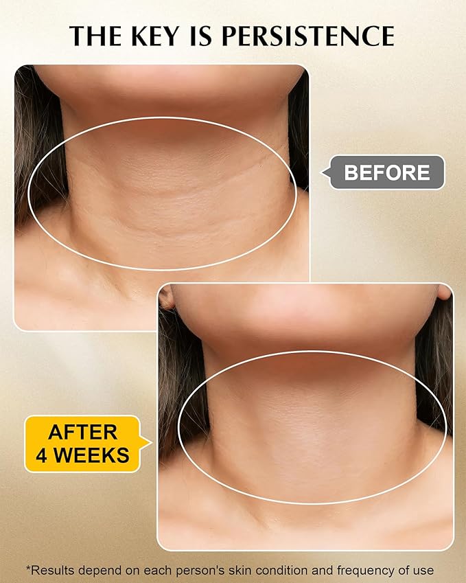 Neck Firming Cream with 3% Retinol - Hyaluronic Acid, Anti-Wrinkle Treatment, Skin Tightening Cream for Face, Neck, Chest & Décolleté-FemmiqueWomen