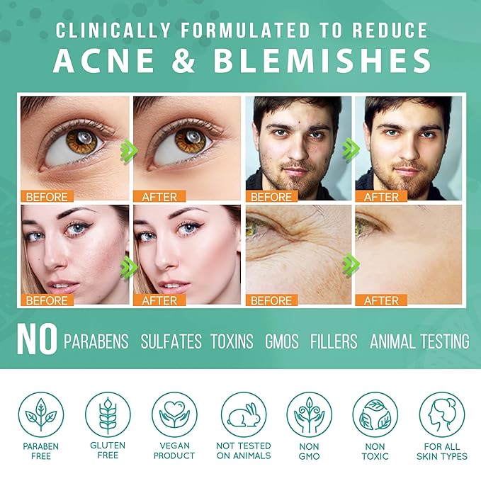 LILY SADO TEA+C™ Green Tea & Vitamin C Face Cleanser – Natural Vegan Antioxidant Daily Face Wash with Aloe, Rosehip, Meadowfoam - Gentle Deep Cleansing for Acne, Blackheads, Blemishes. 8 oz-FemmiqueWomen