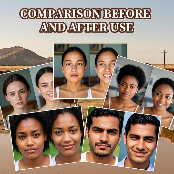 Beef Tallow for Skin, Tallow and Honey Balm, Facial Moisturizer Cream, 100% Organic Grass Fed Whipped Beef Tallow Balm Deeply Moisturizing for Face & Body, Suitable For All Skin Types(3.53oz)-FemmiqueWomen